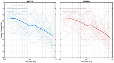 Comparing In-ear EOG for Eye-Movement Estimation With Eye-Tracking: Accuracy, Calibration, and Speech Comprehension